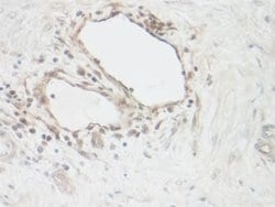 Invitrogen CNTF Polyclonal Antibody 100 &mu;g; Unconjugated:Antibodies,