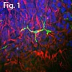 Invitrogen Coronin 1A Polyclonal Antibody 100 &mu;L; Unconjugated:Antibodies,