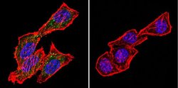 Invitrogen CRABP1 Monoclonal Antibody (C-1) 100 &mu;L; Unconjugated:Antibodies,