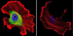 Invitrogen CRABP1 Monoclonal Antibody (C-1) 100 &mu;L; Unconjugated:Antibodies,