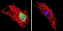 Invitrogen CRABP1 Monoclonal Antibody (C-1) 100 &mu;L; Unconjugated:Antibodies,