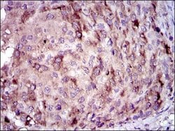 Invitrogen CRP Monoclonal Antibody (1G1) 100 &mu;L; Unconjugated:Antibodies,
