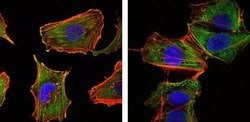 Torc1 Monoclonal Antibody (1B5):Antibodies, Monoclonal