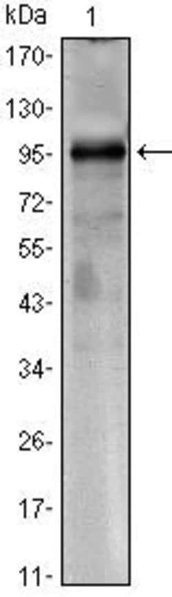 Torc1 Monoclonal Antibody (1B5):Antibodies, Monoclonal