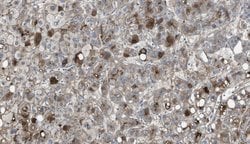 Invitrogen Vitronectin Monoclonal Antibody (HV2) 400 &mu;L; Unconjugated:Antibodies,