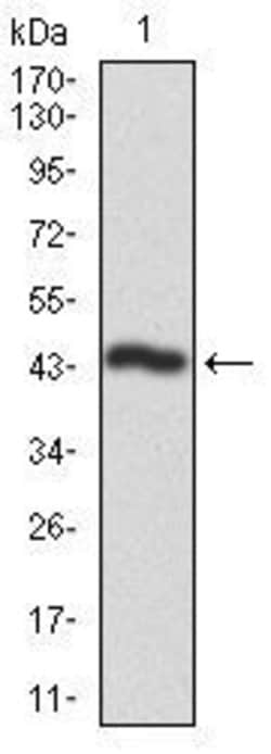 Invitrogen CK2 alpha-2 Monoclonal Antibody (1E1) 100 &mu;L; Unconjugated:Antibodies,