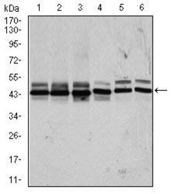 Invitrogen CK2 alpha-2 Monoclonal Antibody (1E1) 100 &mu;L; Unconjugated:Antibodies,