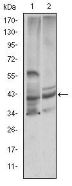 Invitrogen Cystatin C Monoclonal Antibody (5H2) 100 &mu;L; Unconjugated:Antibodies,