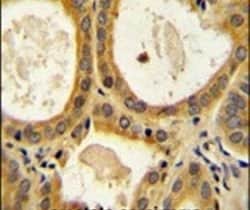 CTLA-4 Rabbit anti-Human, Polyclonal, Invitrogen 200 &mu;L | Buy Online | Invitrogen | Fisher Scientific