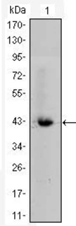 Invitrogen beta Catenin Monoclonal Antibody (4D5) 100 &mu;L; Unconjugated:Antibodies,