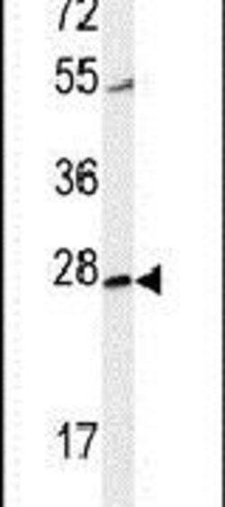 CWC15 Rabbit anti-Hamster, Human, Polyclonal, Invitrogen 400 &mu;L; Unconjugated:Antibodies,