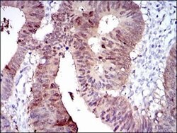 Invitrogen CYP1A1 Monoclonal Antibody (6G5) 100 &mu;g; Unconjugated:Antibodies,