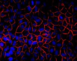 Invitrogen Pan-cadherin Polyclonal Antibody 100 &mu;g; Unconjugated:Antibodies,