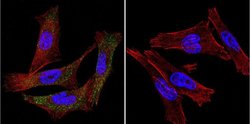 Invitrogen P-cadherin Monoclonal Antibody (6A9) 100 &mu;g; Unconjugated:Antibodies,