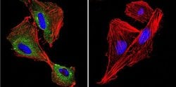 Invitrogen P-cadherin Monoclonal Antibody (6A9) 100 &mu;g; Unconjugated:Antibodies,