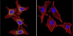 Invitrogen P-cadherin Monoclonal Antibody (6A9) 100 &mu;g; Unconjugated:Antibodies,