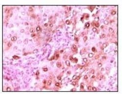 Invitrogen Calcyclin Monoclonal Antibody (7D11) 100 &mu;g; Unconjugated:Antibodies,