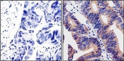 Invitrogen Calpain 1 Monoclonal Antibody (P-6(2H7)) 100 &mu;g; Unconjugated:Antibodies,