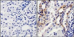 Invitrogen Calpain 1 Monoclonal Antibody (P-6(2H7)) 100 &mu;g; Unconjugated:Antibodies,