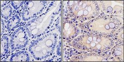 Invitrogen Calpain 1 Monoclonal Antibody (P-6(2H7)) 100 &mu;g; Unconjugated:Antibodies,