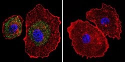 Invitrogen Calsequestrin Monoclonal Antibody (VIIID12) 100 &mu;L; Unconjugated:Antibodies,
