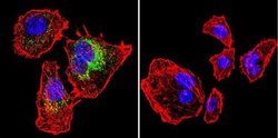 Invitrogen Calsequestrin Monoclonal Antibody (VIIID12) 100 &mu;L; Unconjugated:Antibodies,