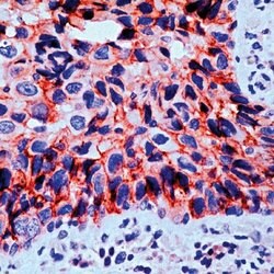 gamma Catenin Polyclonal Antibody:Antibodies, Polyclonal