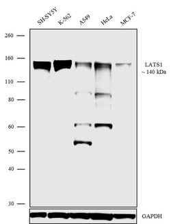 Invitrogen LATS1 Recombinant Rabbit Monoclonal Antibody (2H43L6) 100 &mu;g;