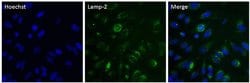 Invitrogen LAMP2 Monoclonal Antibody (H4B4) 100 &mu;g; Unconjugated:Antibodies,