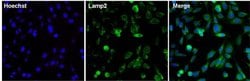 Invitrogen LAMP2 Monoclonal Antibody (H4B4) 100 &mu;g; Unconjugated:Antibodies,
