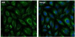 Invitrogen Clathrin Heavy Chain Monoclonal Antibody (X22), Alexa Fluor