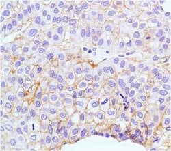 Invitrogen Claudin 1 Monoclonal Antibody (SP128) 500 &mu;L; Unconjugated:Antibodies,