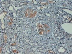 Invitrogen Complement C4d Polyclonal Antibody 250 &mu;L; Unconjugated:Antibodies,