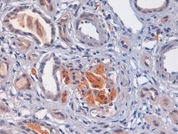 Invitrogen Complement C4d Polyclonal Antibody 250 &mu;L; Unconjugated:Antibodies,