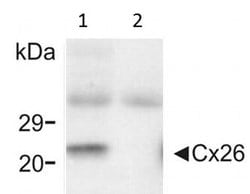 Invitrogen&trade;&nbsp;Connexin 26 Monoclonal Antibody (CX-12H10)