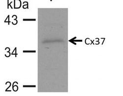Invitrogen Connexin 37 Polyclonal Antibody 100 &mu;g | Buy Online | Invitrogen&trade; | Fisher Scientific