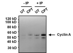 Invitrogen Cyclin A2 Monoclonal Antibody (E23.1) 100 &mu;g; Unconjugated:Antibodies,