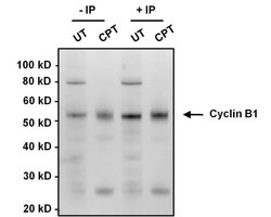Invitrogen Cyclin B1 Monoclonal Antibody (V152) 100 &mu;g; Unconjugated:Antibodies,