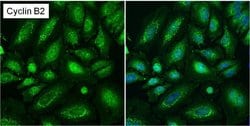 Invitrogen Cyclin B2 Monoclonal Antibody (X29.2) 100 &mu;g; Unconjugated:Antibodies,