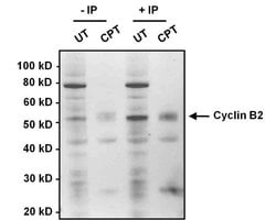 Invitrogen Cyclin B2 Monoclonal Antibody (X29.2) 100 &mu;g; Unconjugated:Antibodies,