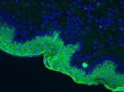 Invitrogen Cytokeratin 10 Monoclonal Antibody (RKSE60) 100 &mu;g | Buy Online | Invitrogen&trade; | Fisher Scientific