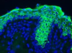 Invitrogen&trade;&nbsp;Cytokeratin 10 Monoclonal Antibody (RKSE60)