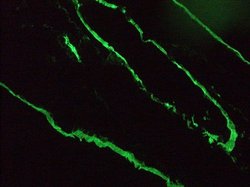 Invitrogen Cytokeratin 18 Monoclonal Antibody (RGE53) 100 &mu;L; Unconjugated:Antibodies,