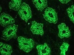 Invitrogen Cytokeratin 18 Monoclonal Antibody (RGE53) 100 &mu;L; Unconjugated:Antibodies,