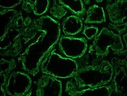 Invitrogen Cytokeratin 18 Monoclonal Antibody (RGE53) 100 &mu;L; Unconjugated:Antibodies,