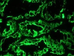 Invitrogen Cytokeratin 18 Monoclonal Antibody (RCK106) 100 &mu;g; Unconjugated:Antibodies,
