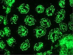 Invitrogen Cytokeratin 18 Monoclonal Antibody (RCK106) 100 &mu;g; Unconjugated:Antibodies,