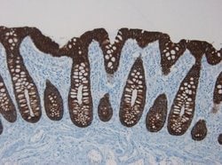 Invitrogen Cytokeratin 18 Monoclonal Antibody (RCK106) 100 &mu;g; Unconjugated:Antibodies,