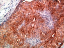 Cytokeratin 18 Monoclonal Antibody (E431-1), Invitrogen 1 mL; Unconjugated:Antibodies,