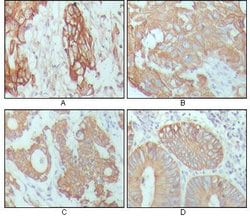 Invitrogen Cytokeratin 18 Monoclonal Antibody (4D11E4) 100 &mu;L; Unconjugated:Antibodies,